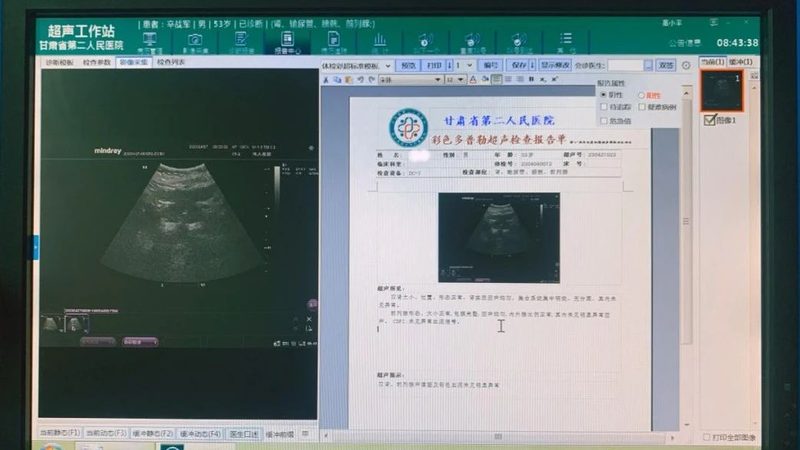 高端体检品牌报价单背后的考量因素